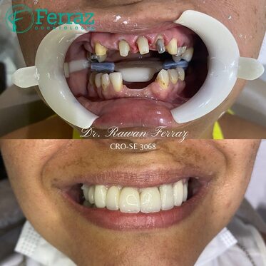 Ferraz odontologia 4