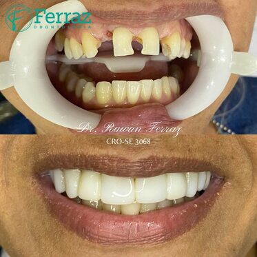 Ferraz odontologia 5